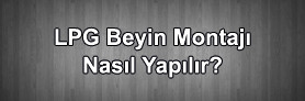 Lpg Beyin Montajı Nasıl Yapılır ?