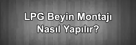 Lpg Beyin Montajı Nasıl Yapılır ?